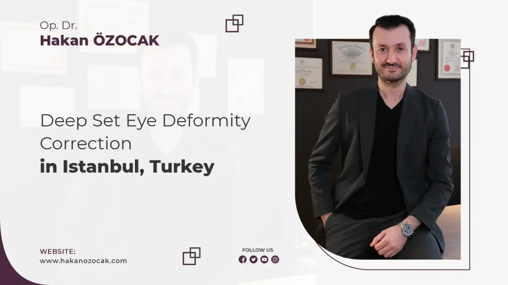 Deep Set Eye Deformity Correction in Istanbul, Turkey