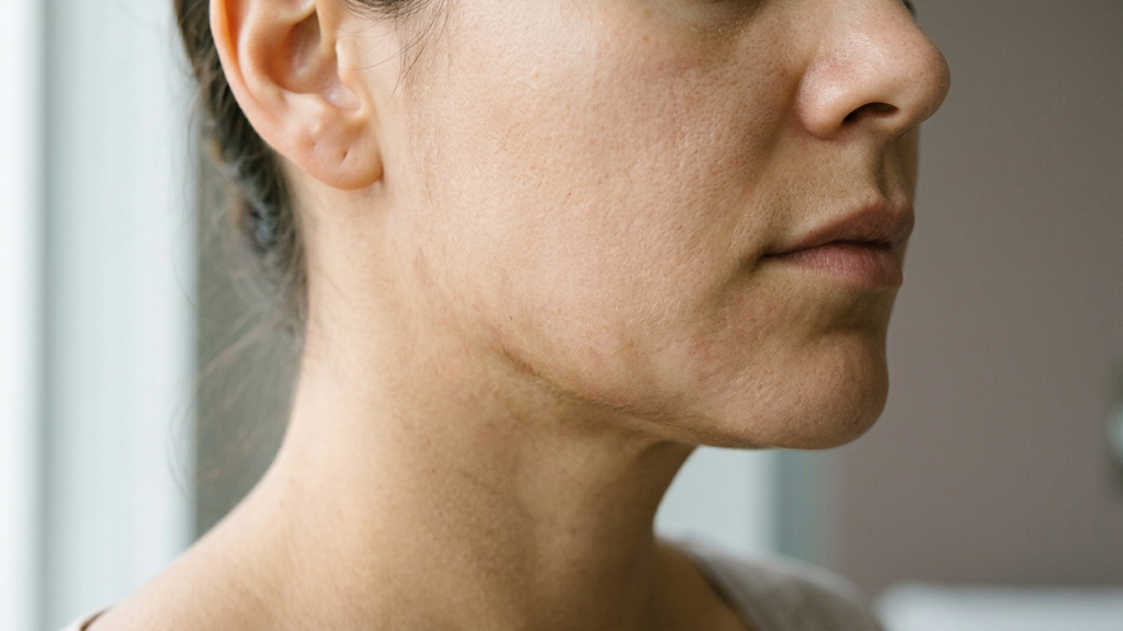 A patient tracking their healing progress during the deep plane facelift recovery phase at home.